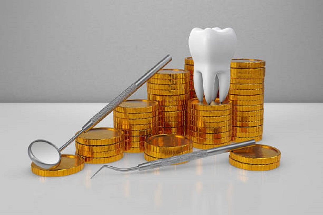 Is Dental Bonding Covered by Insurance